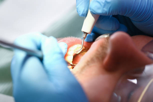 Best After-Hours Emergency Dentist in Bassett, VA