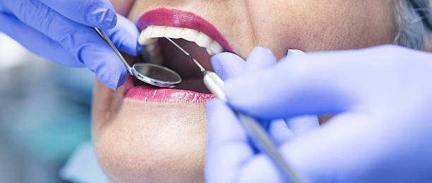 Best Emergency Root Canal Treatment in Bassett, VA